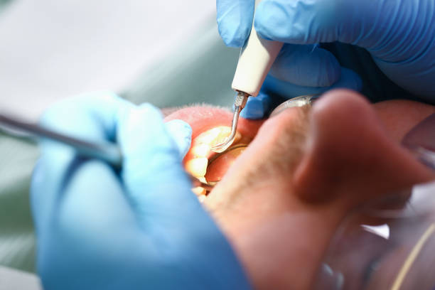 Best Broken or Cracked Tooth Emergency Dentist in Leo Cedarville, IN